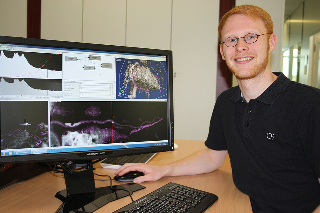 Foto (Universität Paderborn, Katharina Bätz): Stephan Arens vor einer Grafik, die die schnelle Erkennung von Ablagerungen in den Koronargefäßen möglich macht.